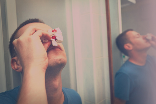 Парень вытирает кровь из носа салфеткой